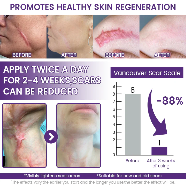 SKINIX™ Timilk Regenscar Stem Cell Scar Gel